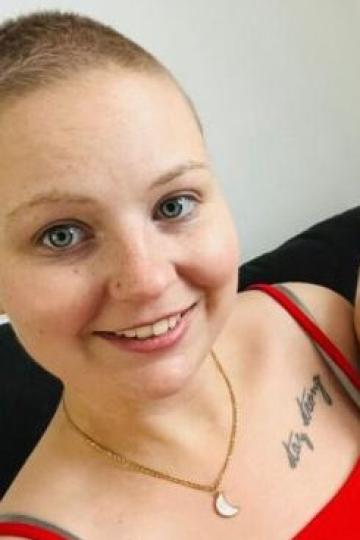 Durch die Chemotherapie verlor Anna Falch ihre Haare. 