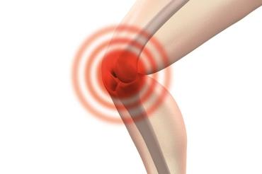 Das Bild zeigt ein Kniegelenk