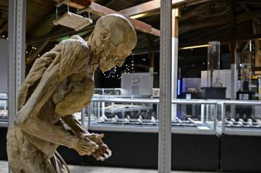 Zu sehen ist ein Modell des menschlichen Körpers. 