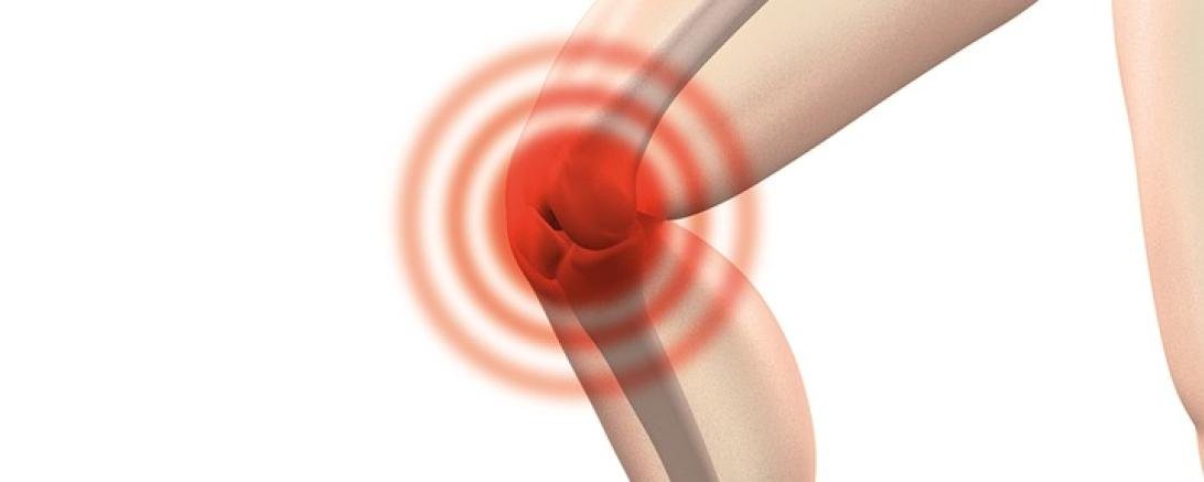 Das Bild zeigt ein Kniegelenk