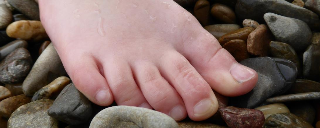 Das Bild zeigt eines Fuß.