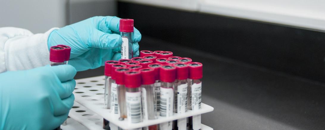 Blutproben im Labor.