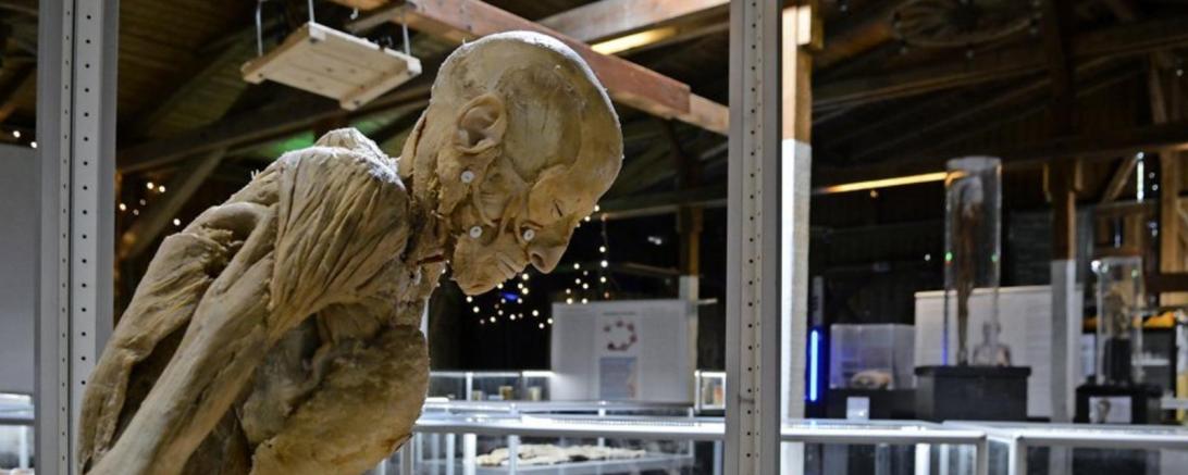 Zu sehen ist ein Modell des menschlichen Körpers. 