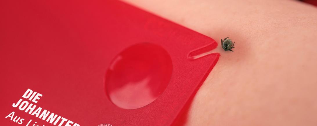 Bei einem Zeckenbiss sollte schnell gehandelt werden.