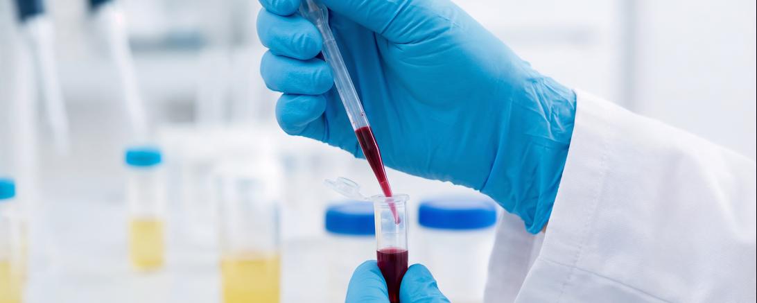 Die HIV-Testwochen 2026 starten!